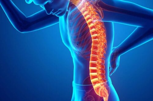 Hogyan kezeljük hatékonyan az isiász miatt kialakuló panaszokat?